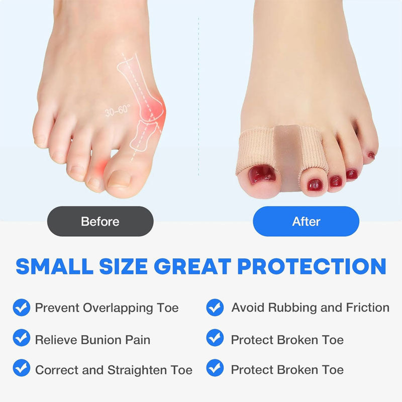 Tåseparator & hallux valgus-korrigerare 🦶